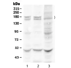 Thrombospondin Antibody / THBS1 - image 1