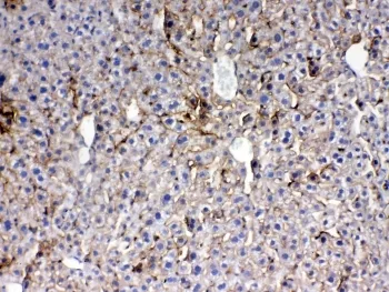 Thrombopoietin Antibody / THPO - image 1