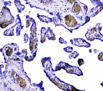 Hemoglobin Antibody (subunit alpha) - image 1