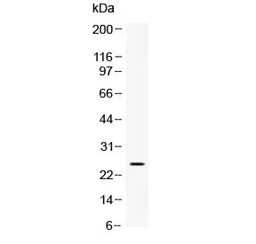 Vegfa Antibody / Vascular endothelial growth factor a - image 1