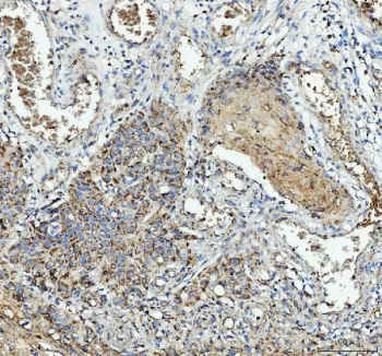 IL1RA Antibody / Interleukin-1 Receptor Antagonist - image 1