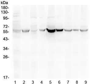 Estrogen Receptor beta Antibody - image 1