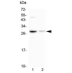Oncostatin M Antibody / OSM - image 1