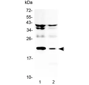 Il-11 Antibody - image 1