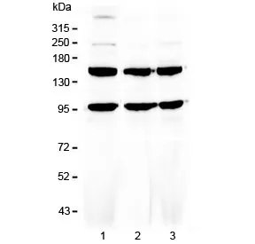 VEGF Receptor 3 Antibody / VEGFR3 - image 1