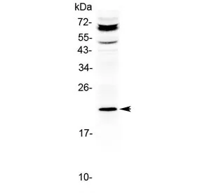 ANGPTL8 Antibody / Betatrophin / C19orf80 - image 1