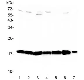 WFDC2 Antibody / HE4 - image 1
