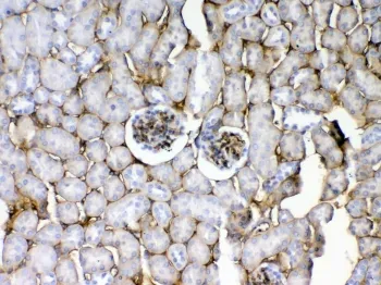 CD105 Antibody / Endoglin - image 1
