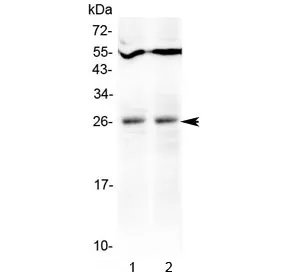LIGHT Antibody / TNFSF14 / HVEML - image 1