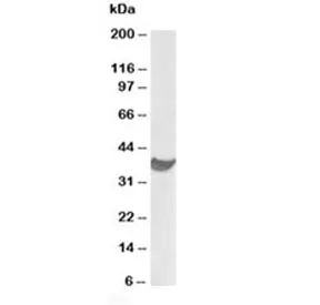 PD-L1 Antibody - image 1