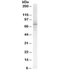 PCSK9 Antibody - image 1