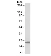 MCT-1 Antibody / MCTS1 - image 1