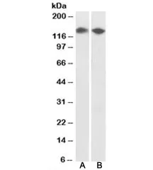 DBC1 Antibody - image 1