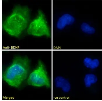BDNF Antibody - image 1