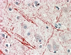 IGF2 Antibody - image 1