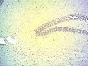 DIO2 Antibody - image 1