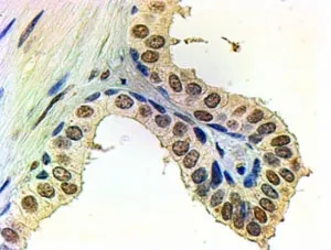 Androgen receptor Antibody - image 1