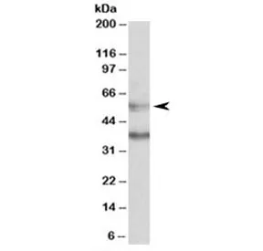 CBARA1 Antibody / MICU1 - image 1