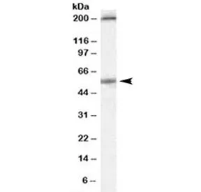 Serotonin Receptor 3A Antibody - image 1