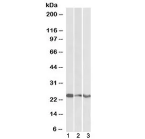 TREM2 Antibody - image 1