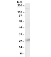 Synaptogyrin 4 Antibody - image 1