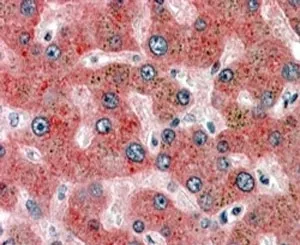 Alpha-2-Antiplasmin Antibody - image 1