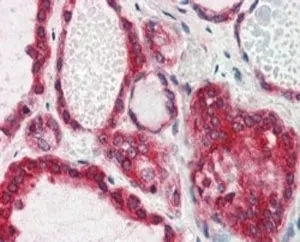 Lipin 3 Antibody - image 1