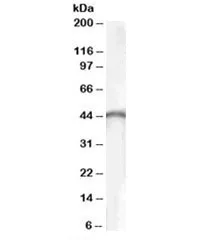 Brain Creatine Kinase Antibody - image 1