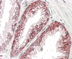 Alpha-Catenin Antibody - image 1