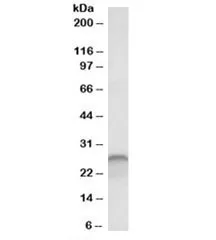 Calbindin 1 Antibody - image 1