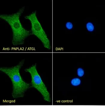 Adipose triglyceride lipase Antibody - image 1