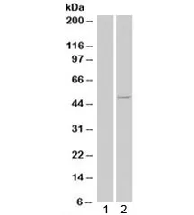 CSNK1E Antibody - image 1