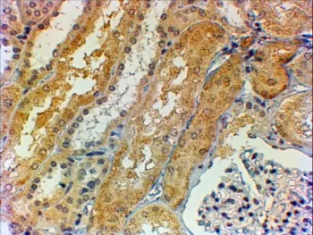 Tensin 1 Antibody - image 1