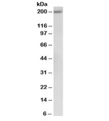 Alpha-2-macroglobulin Antibody - image 1