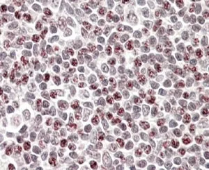 APOBEC3A Antibody - image 1