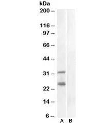 SOCS1 Antibody - image 1