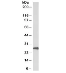 CFD Antibody / Complement Factor D - image 1