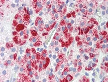 Clathrin Heavy Chain Antibody - image 1