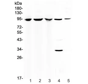C7 Antibody / Complement component C7 - image 1