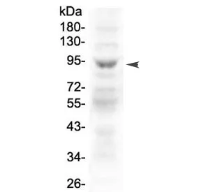 MAP3K20 Antibody - image 1