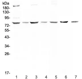 MST1 Antibody (Hepatocyte growth factor-like protein) - image 1