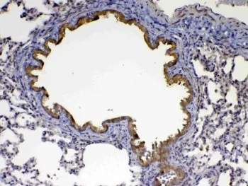 CFD Antibody / Complement Factor D - image 1