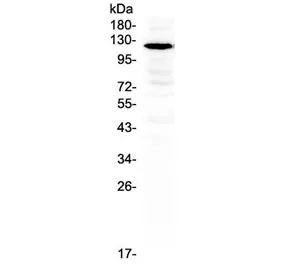 GRIN1 Antibody / NMDAR1 - image 1
