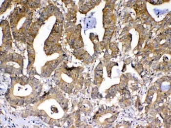PPID Antibody - image 1