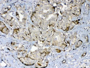 GAD65 Antibody - image 1