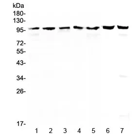 TOP1 Antibody / Topoisomerase I - image 1