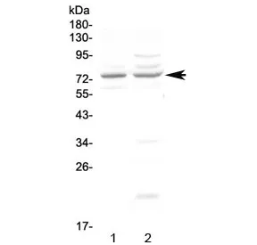 CHM Antibody / Choroideremia protein - image 1