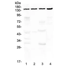 TRPC4 Antibody / Short transient receptor potential channel 4 - image 1
