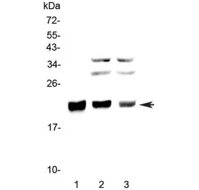 CBFB Antibody / Core-binding factor subunit beta - image 1