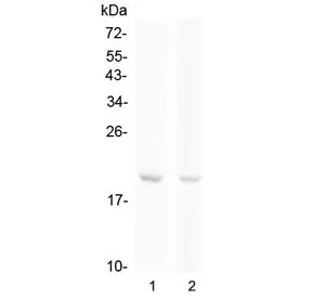 BCMA Antibody / CD269 / TNFRSF17 - image 1